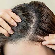 Is it safe to take hair supplements on allergic scalp